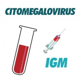 AC Anti Citomegalovirus IGM