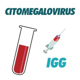 AC Anti Citomegalovirus IGG