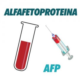 AC Alfafetoproteina